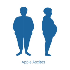 Five-Mobility-Bariatric-Apple-Ascites